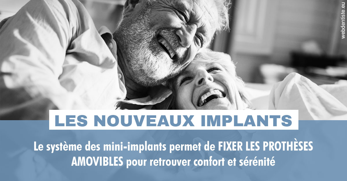 https://dr-jean-de-malbosc.chirurgiens-dentistes.fr/Les nouveaux implants 2