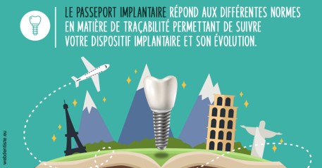 https://dr-jean-de-malbosc.chirurgiens-dentistes.fr/Le passeport implantaire