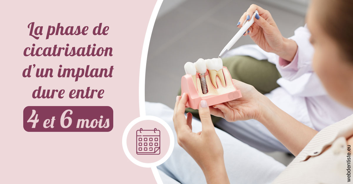 https://dr-jean-de-malbosc.chirurgiens-dentistes.fr/Cicatrisation implant 2