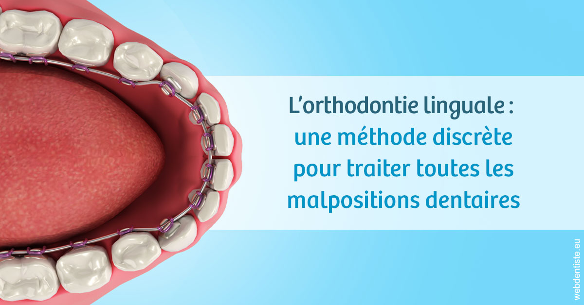 https://dr-jean-de-malbosc.chirurgiens-dentistes.fr/L'orthodontie linguale 1