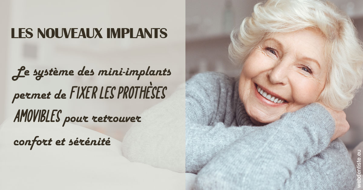 https://dr-jean-de-malbosc.chirurgiens-dentistes.fr/Les nouveaux implants 1