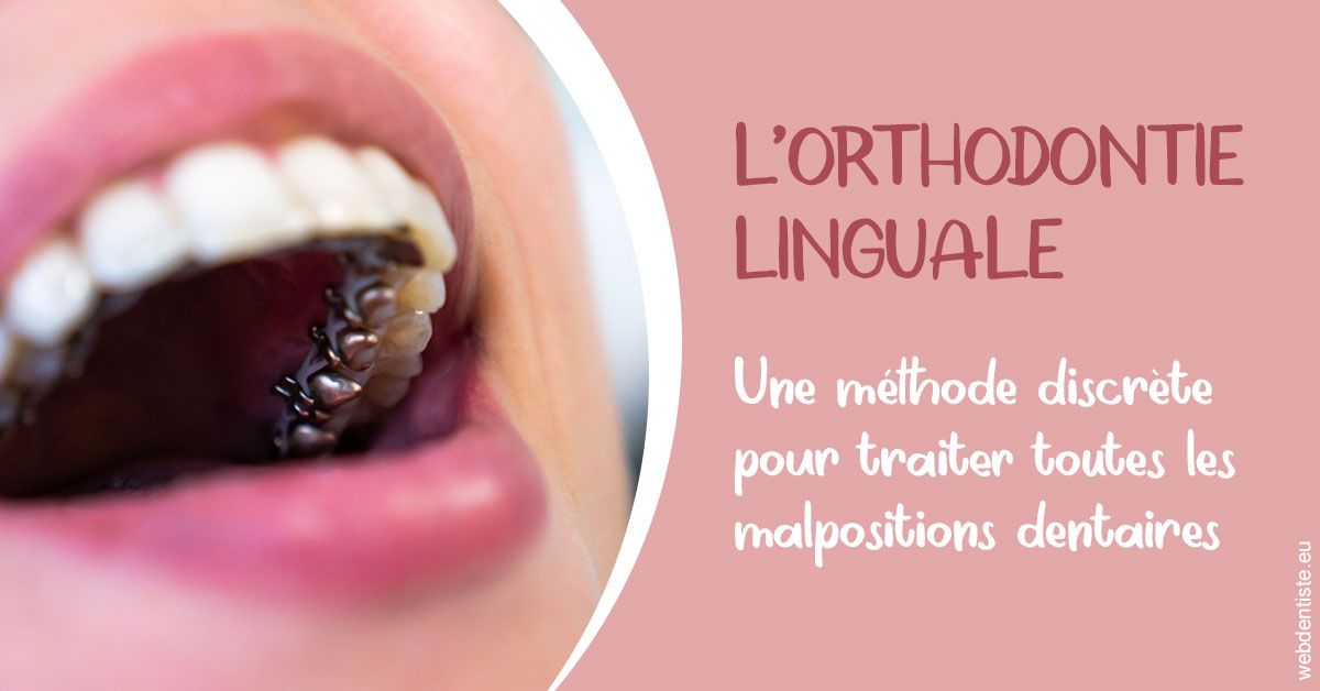 https://dr-jean-de-malbosc.chirurgiens-dentistes.fr/L'orthodontie linguale 2