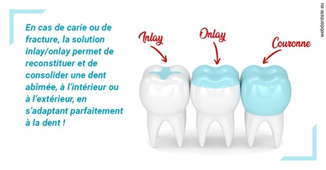 https://dr-jean-de-malbosc.chirurgiens-dentistes.fr/L'INLAY ou l'ONLAY