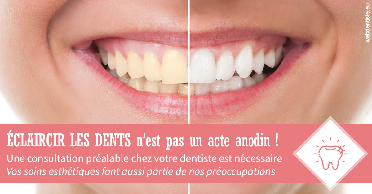 https://dr-jean-de-malbosc.chirurgiens-dentistes.fr/Eclaircir les dents 1