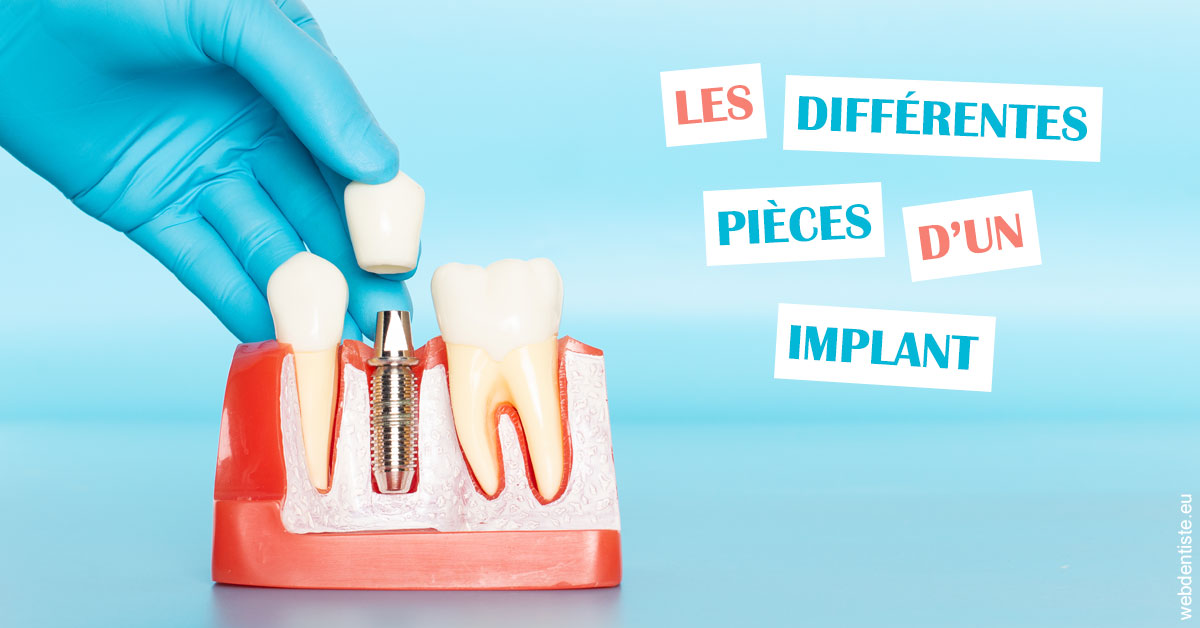 https://dr-jean-de-malbosc.chirurgiens-dentistes.fr/Les différentes pièces d’un implant 2