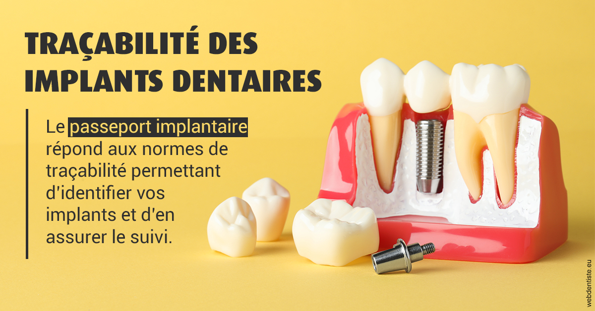 https://dr-jean-de-malbosc.chirurgiens-dentistes.fr/T2 2023 - Traçabilité des implants 2