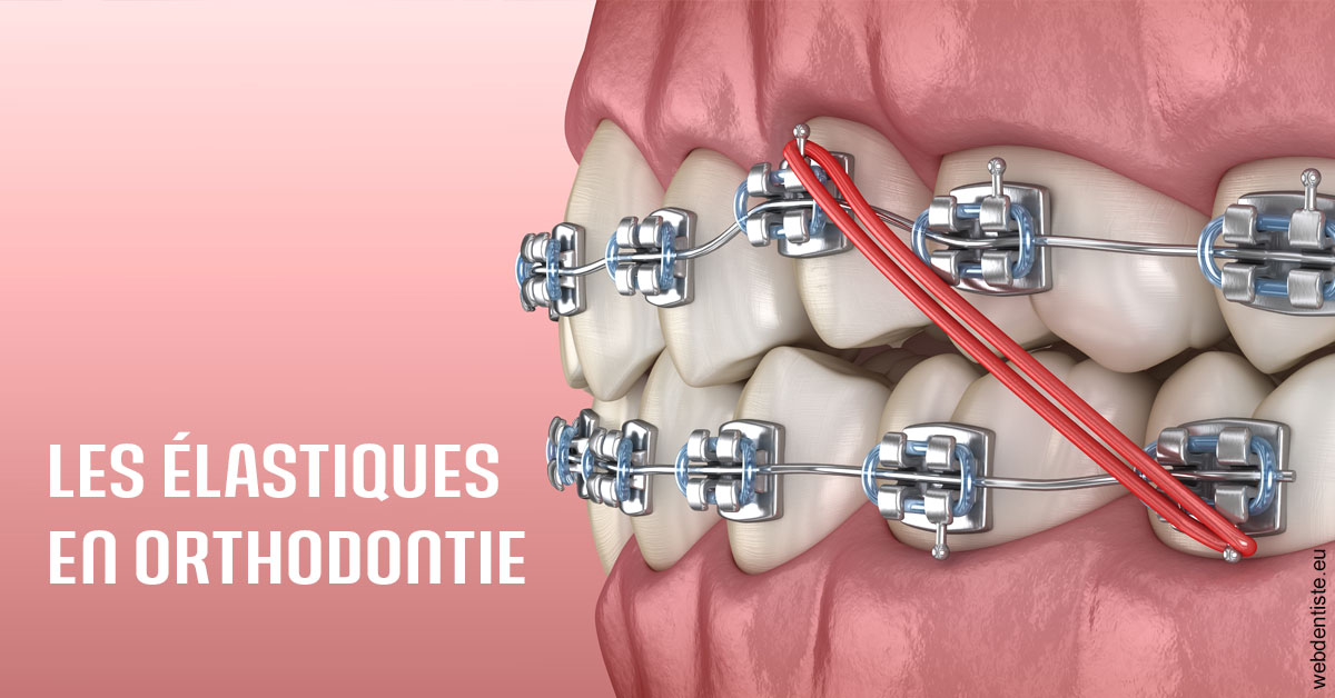 https://dr-jean-de-malbosc.chirurgiens-dentistes.fr/Elastiques orthodontie 2