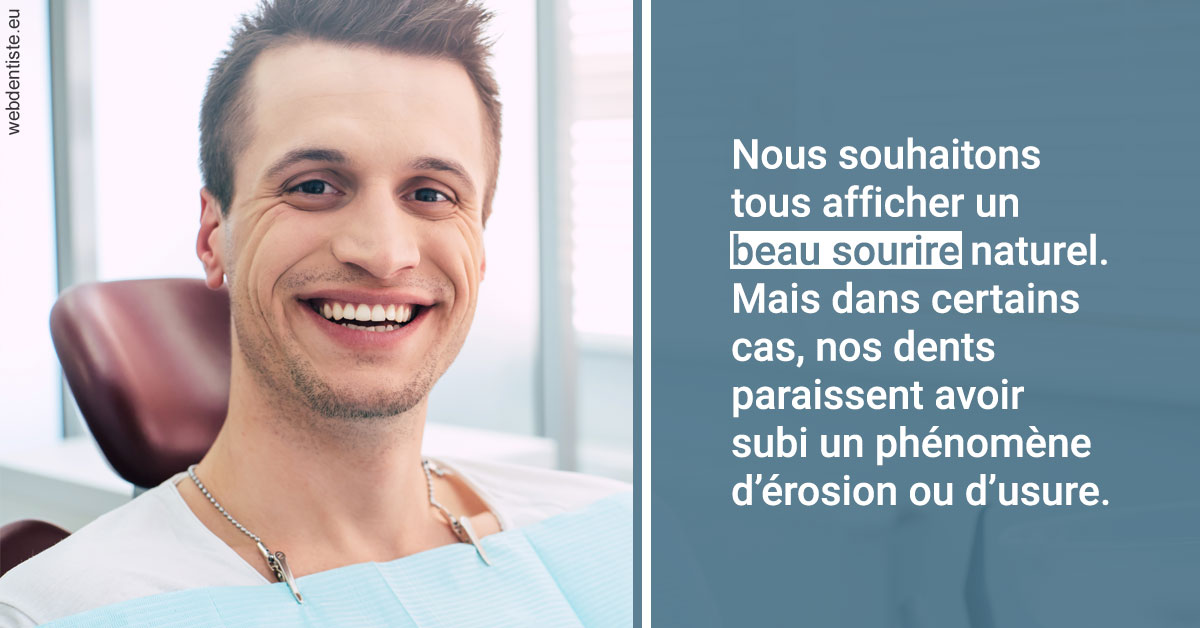 https://dr-jean-de-malbosc.chirurgiens-dentistes.fr/Érosion et usure dentaire