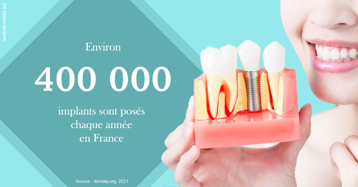 https://dr-jean-de-malbosc.chirurgiens-dentistes.fr/Pose d'implants en France 2